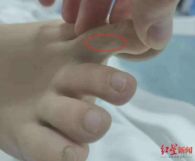 “27岁女子三亚旅游疑被不明物咬伤身亡”家属：事发夜晚天黑看不清咬人之物未来有考虑尸检(图1)